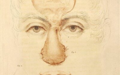 Geschichte der Schönheitschirurgie