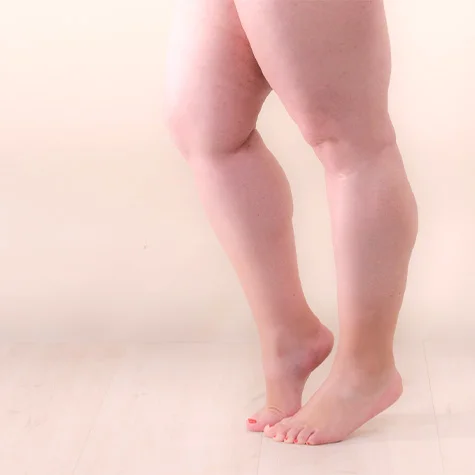 Lipödem Waden München