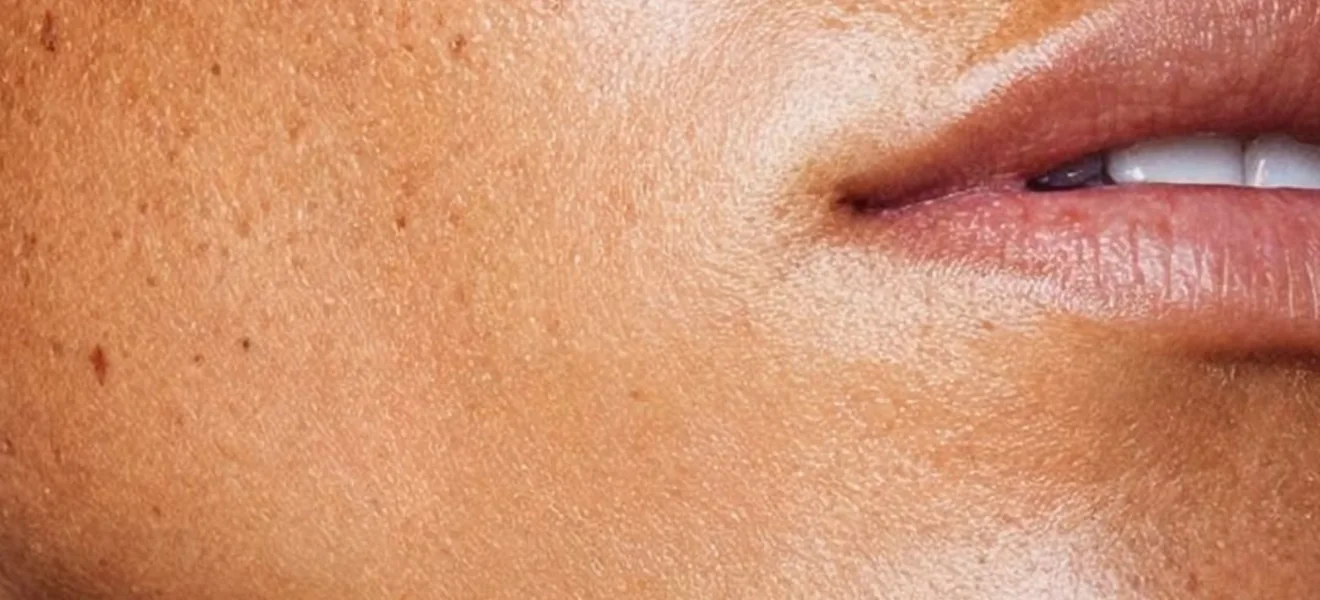 Nahaufnahme der Gesichtshaut an Wange und Mundpartie